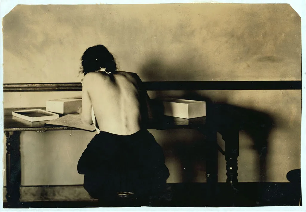 [Fannie Bowman, 15 years old. Postural deformity. Correct position in…, Massachusetts, 1917