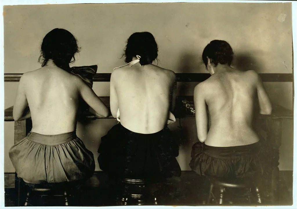 Incorrect sitting position for postural deformity and dorsal…, Massachusetts, 1917