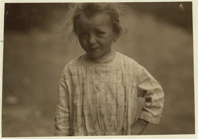 Three-year old Hilda, who is beginning beet work on a Wisconsin farm.…, 1915