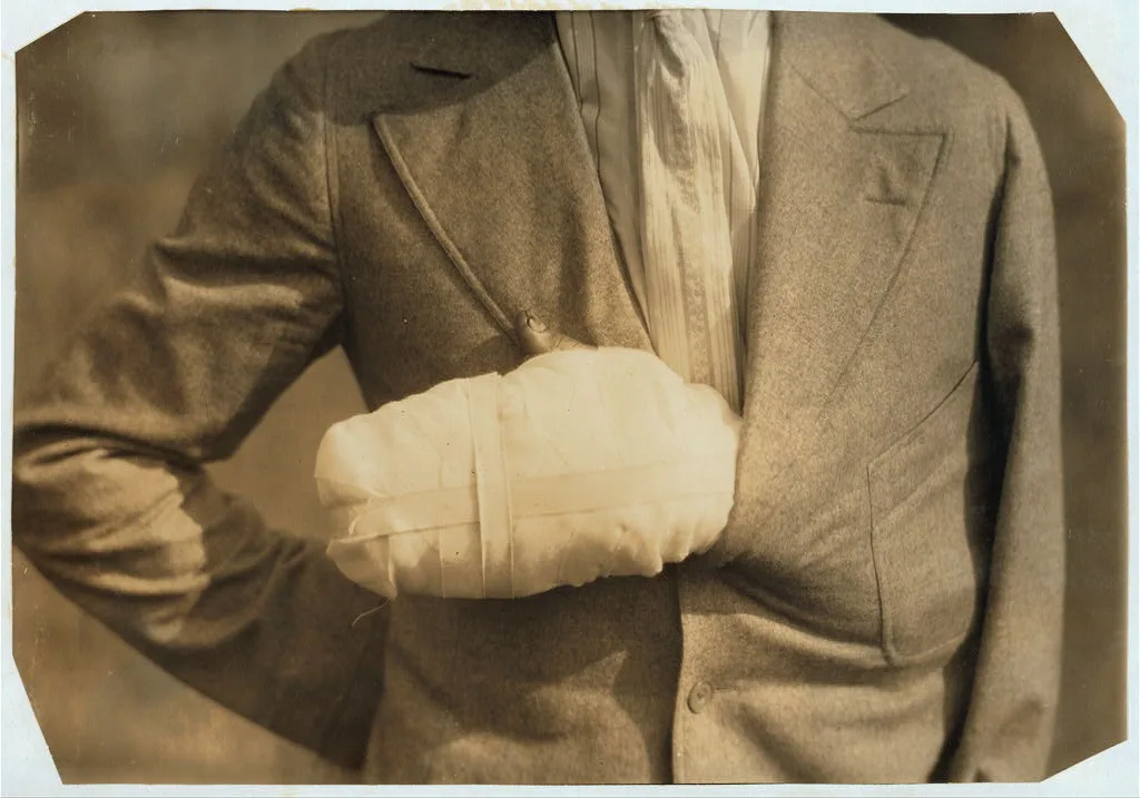 Accident case - Man with hand crushed by flywheel at Offset Litho Co.…, Massachusetts, 1916